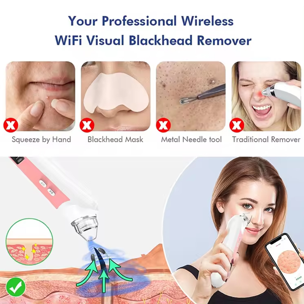 6 Heads Pore Cleaner Blackhead - đánh giá và giá Nasal Aspirator