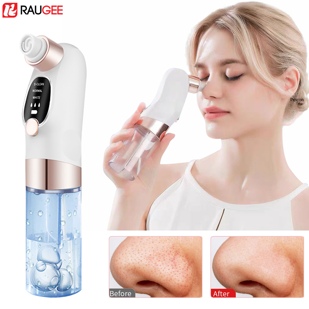 Blackhead Remover Electric Bla - đánh giá và giá Nasal Aspirator
