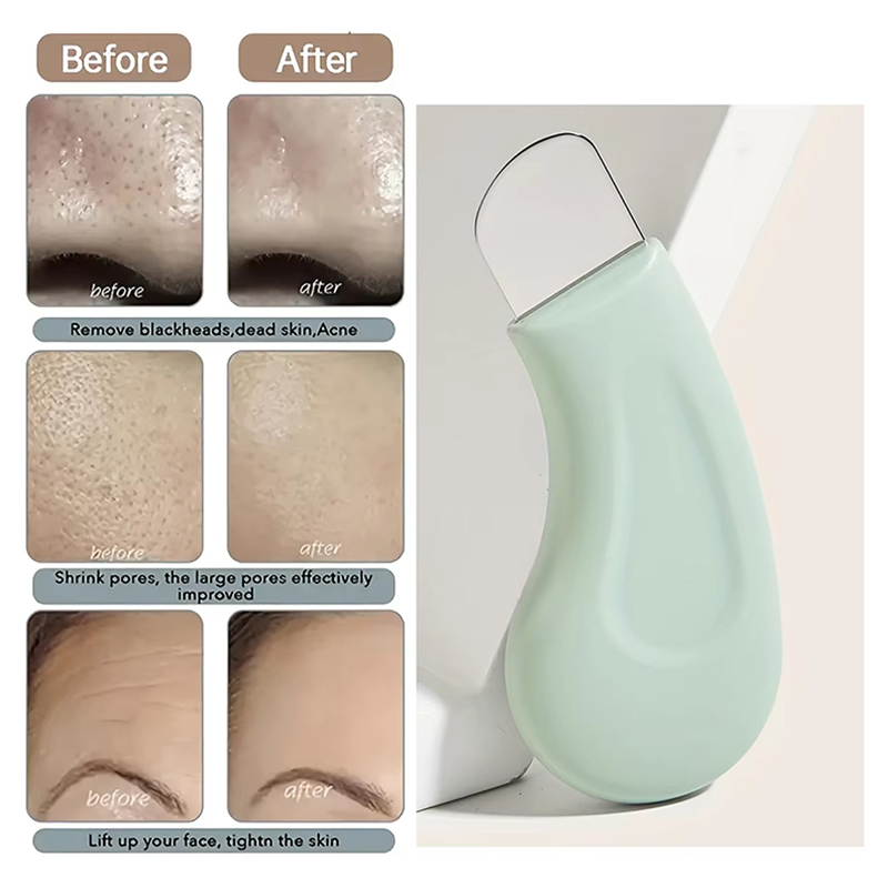 Deep Cleansing Facial Blackhea - đánh giá và giá Nasal Aspirator
